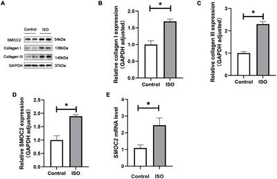Suppression of SMOC2 alleviates myocardial fibrosis via the ILK/p38 pathway
